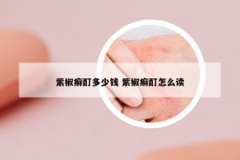 紫椒癬酊多少錢 紫椒癬酊怎么讀
