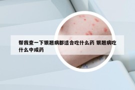 幫我查一下銀翹病都適合吃什么藥 銀翹病吃什么中成藥