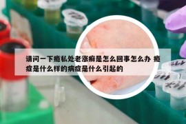 請(qǐng)問(wèn)一下癮私處老漲癬是怎么回事怎么辦 癮癥是什么樣的病癥是什么引起的