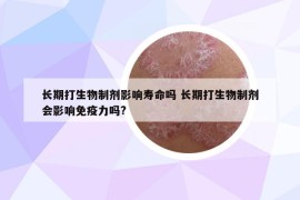 長期打生物制劑影響壽命嗎 長期打生物制劑會影響免疫力嗎?