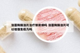 溶菌酶腸溶片治療銀屑病嗎 溶菌酶腸溶片可以增強免疫力嗎
