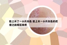 臉上長了一小片白色 臉上長一小片白色的疙瘩之前癢后來疼