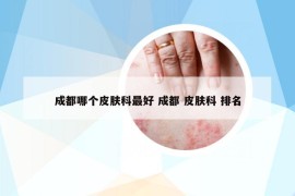 成都哪個皮膚科最好 成都 皮膚科 排名