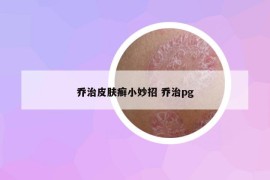 喬治皮膚癬小妙招 喬治pg