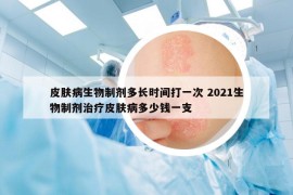 皮膚病生物制劑多長時(shí)間打一次 2021生物制劑治療皮膚病多少錢一支