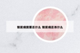 銀屑病需要忌什么 銀屑病忌諱什么