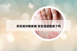 安百諾對(duì)銀屑病 安百諾進(jìn)醫(yī)保了嗎