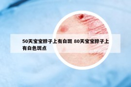 50天寶寶脖子上有白斑 80天寶寶脖子上有白色斑點