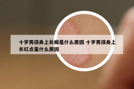 十歲男孩身上長癬是什么原因 十歲男孩身上長紅點(diǎn)是什么原因