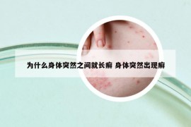 為什么身體突然之間就長(zhǎng)癬 身體突然出現(xiàn)癬