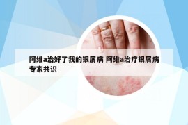 阿維a治好了我的銀屑病 阿維a治療銀屑病專家共識
