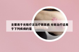主要用于光敏療法治療銀屑病 光敏治療適用于下列疾病的是