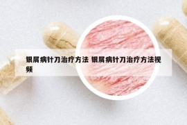 銀屑病針刀治療方法 銀屑病針刀治療方法視頻