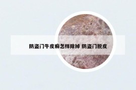 防盜門牛皮癬怎樣除掉 防盜門脫皮