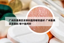 廣州市番禺區(qū)皮膚科醫(yī)院哪家最好 廣州番禺區(qū)皮膚科 哪個醫(yī)院好