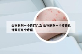 生物制劑一個(gè)月打幾次 生物制劑一個(gè)療程幾針要打幾個(gè)療程