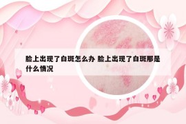 臉上出現(xiàn)了白斑怎么辦 臉上出現(xiàn)了白斑那是什么情況