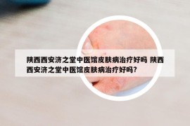 陜西西安濟之堂中醫(yī)館皮膚病治療好嗎 陜西西安濟之堂中醫(yī)館皮膚病治療好嗎?