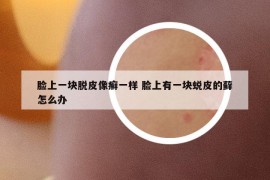 臉上一塊脫皮像癬一樣 臉上有一塊蛻皮的蘚怎么辦