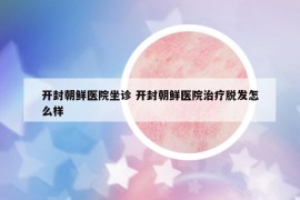 開封朝鮮醫(yī)院坐診 開封朝鮮醫(yī)院治療脫發(fā)怎么樣