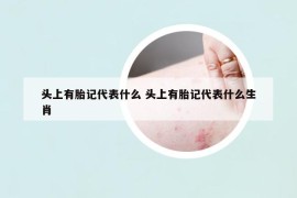 頭上有胎記代表什么 頭上有胎記代表什么生肖