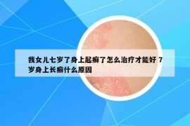 我女兒七歲了身上起癬了怎么治療才能好 7歲身上長(zhǎng)癬什么原因