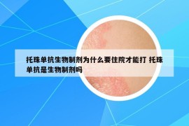 托珠單抗生物制劑為什么要住院才能打 托珠單抗是生物制劑嗎