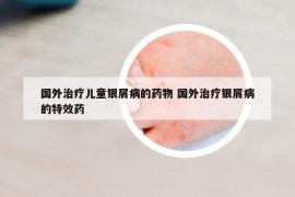 國外治療兒童銀屑病的藥物 國外治療銀屑病的特效藥
