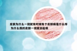 皮膚為什么一撓就有時(shí)候有個(gè)皮膚癬是什么樣 為什么我的皮膚一撓就會(huì)起痕