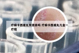 療癬卡西甫丸有激素嗎 療癬卡西甫丸幾盒一療程