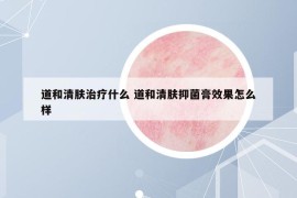 道和清膚治療什么 道和清膚抑菌膏效果怎么樣