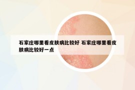 石家莊哪里看皮膚病比較好 石家莊哪里看皮膚病比較好一點(diǎn)