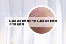 紅霉素軟膏的功效與作用 紅霉素軟膏的功效與作用副作用