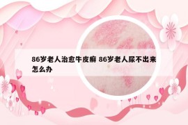 86歲老人治愈牛皮癬 86歲老人尿不出來(lái)怎么辦