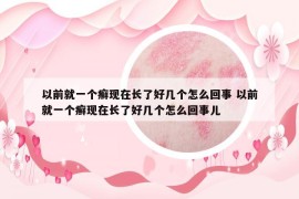 以前就一個癬現(xiàn)在長了好幾個怎么回事 以前就一個癬現(xiàn)在長了好幾個怎么回事兒