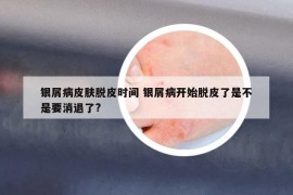 銀屑病皮膚脫皮時間 銀屑病開始脫皮了是不是要消退了?