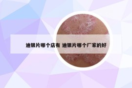 迪銀片哪個(gè)店有 迪銀片哪個(gè)廠家的好