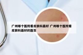 廣州哪個醫(yī)院看皮膚科最好 廣州哪個醫(yī)院看皮膚科最好的醫(yī)生