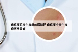 南京哪家治牛皮癬的醫(yī)院好 南京哪個治牛皮癬醫(yī)院最好