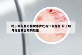 嗎丁啉與復(fù)方胺肽素片吃有什么危害 嗎丁啉與胃復(fù)安合用的后果