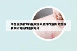 成都皮膚病?？漆t(yī)院哪家最好四道街 成都皮膚病研究所四道街電話