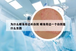 為什么眼角旁邊長白斑 眼角旁邊一個白斑是什么東西