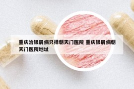 重慶治銀屑病只擇朝天門醫(yī)院 重慶銀屑病朝天門醫(yī)院地址
