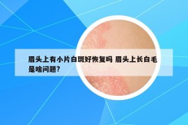 眉頭上有小片白斑好恢復(fù)嗎 眉頭上長白毛 是啥問題?