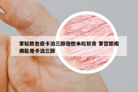 掌趾膿包癥卡泊三醇倍他米松軟膏 掌哲膿皰病能用卡泊三醇