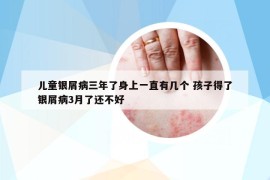 兒童銀屑病三年了身上一直有幾個(gè) 孩子得了銀屑病3月了還不好
