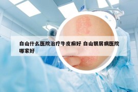 白山什么醫(yī)院治療牛皮癬好 白山銀屑病醫(yī)院哪家好