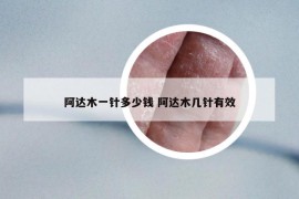 阿達(dá)木一針多少錢 阿達(dá)木幾針有效
