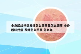 全身起紅疙瘩發(fā)癢怎么回事是怎么回事 全身起紅疙瘩 發(fā)癢怎么回事 怎么辦