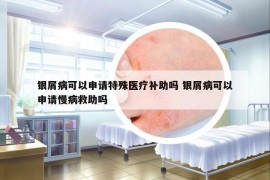 銀屑病可以申請?zhí)厥忉t(yī)療補助嗎 銀屑病可以申請慢病救助嗎